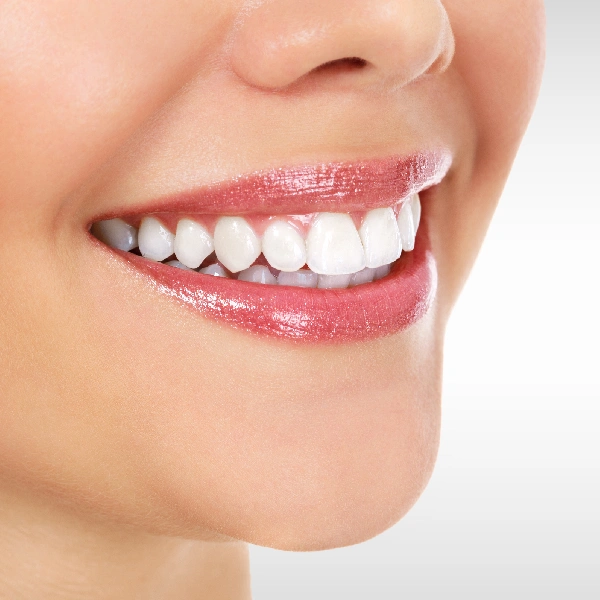 Benefits of Dental Crowns