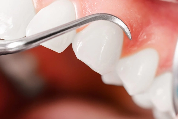 Healthy gums