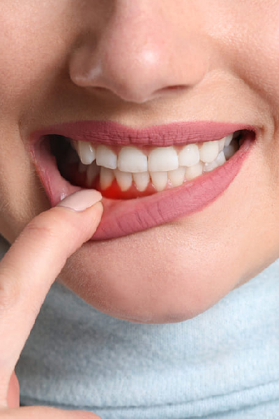 Periodontics in Scarborough