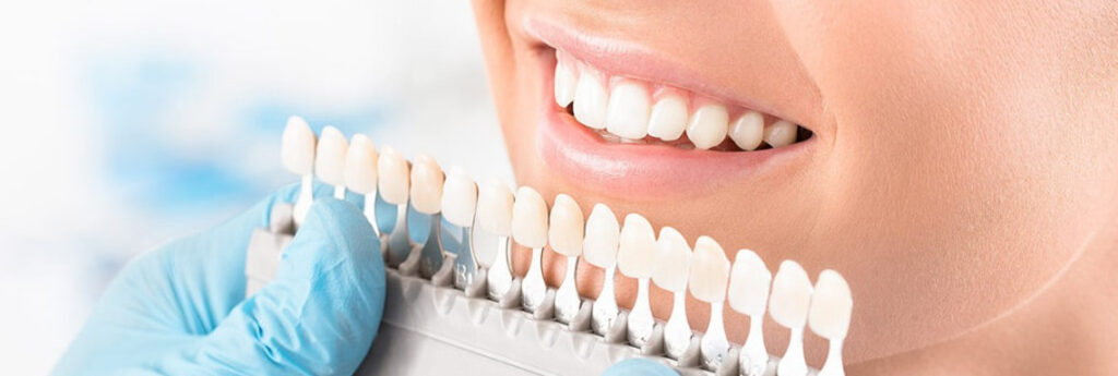 PORCELAIN VENEERS in Scarborough at Tooth Wizard​