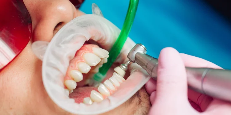 a picture of Professional Teeth Cleaning