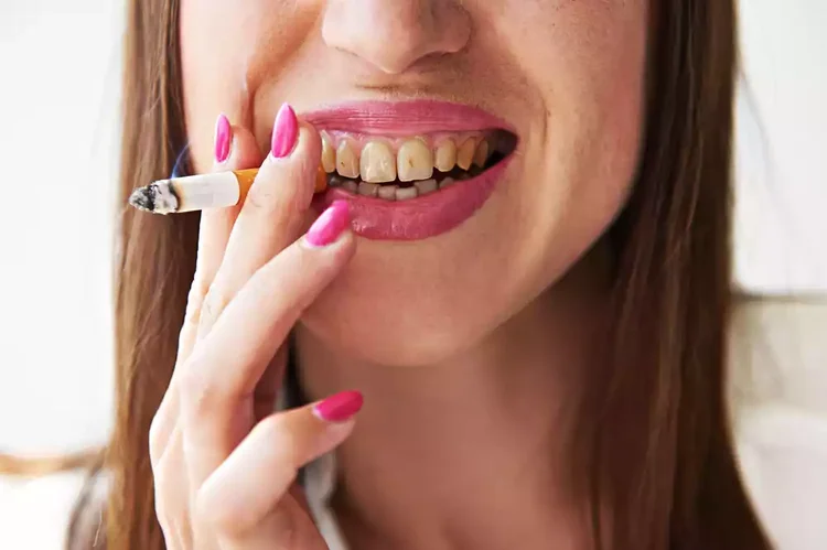 A picture of a lady smoking with yellow teeth