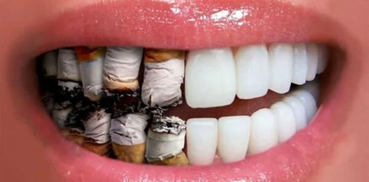 A picture of a set of teeth made of cigarettes