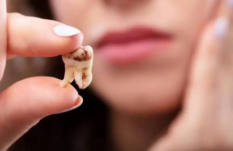 How to prevent cavities