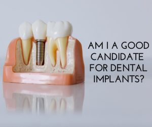 Are You a Candidate for Dental Implants? A 2-Minute Quiz for Scarborough Patients