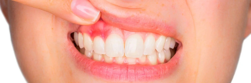 Periodontics-in-Scarborough